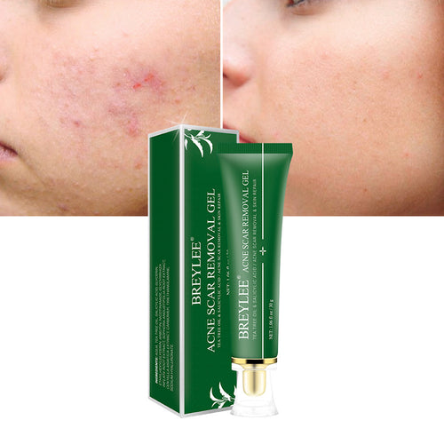 Acne Scar Removal Gel With Tea Tree Oil